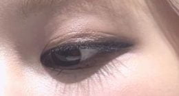 Rose had plastic surgery on her eyelids, did you know?
