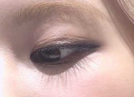 Rose had plastic surgery on her eyelids, did you know?