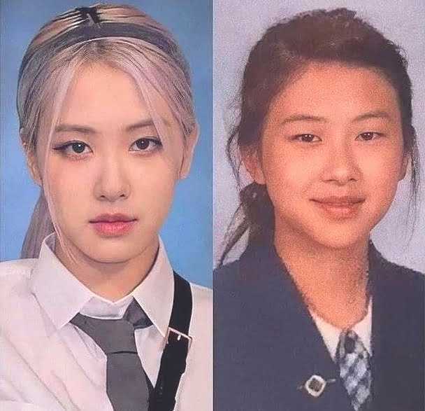 Rose had plastic surgery on her eyelids, did you know?