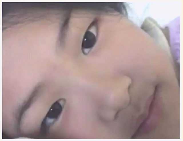 Rose had plastic surgery on her eyelids, did you know?