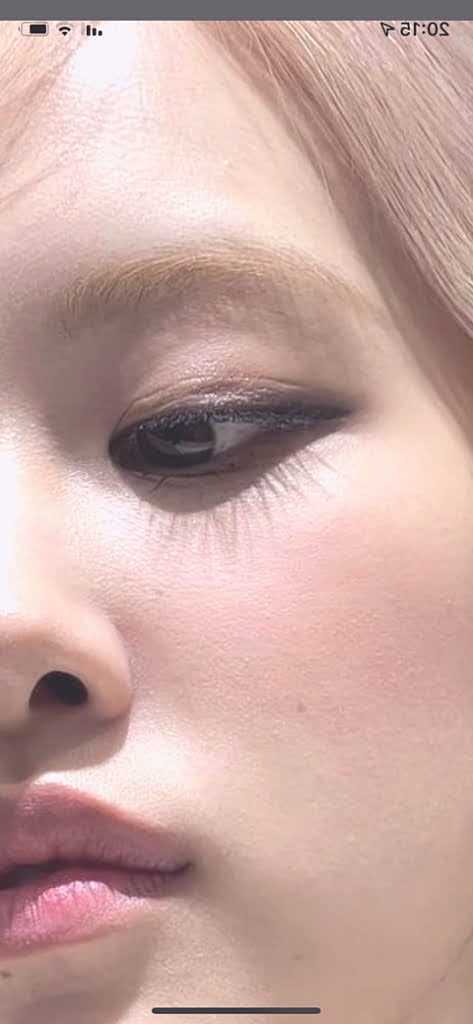 Rose had plastic surgery on her eyelids, did you know?
